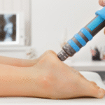 Shockwave Therapy in London: An Innovative Solution for Pain Relief and Recovery